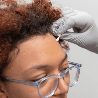 Patient receiving checkup, representing skin cancer in different skin tones